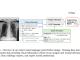 D-Rax: Enhancing Radiologic Precision through Expert-Integrated Vision-Language Models